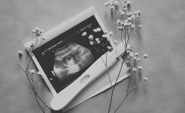 A Passing Fleeting Moment